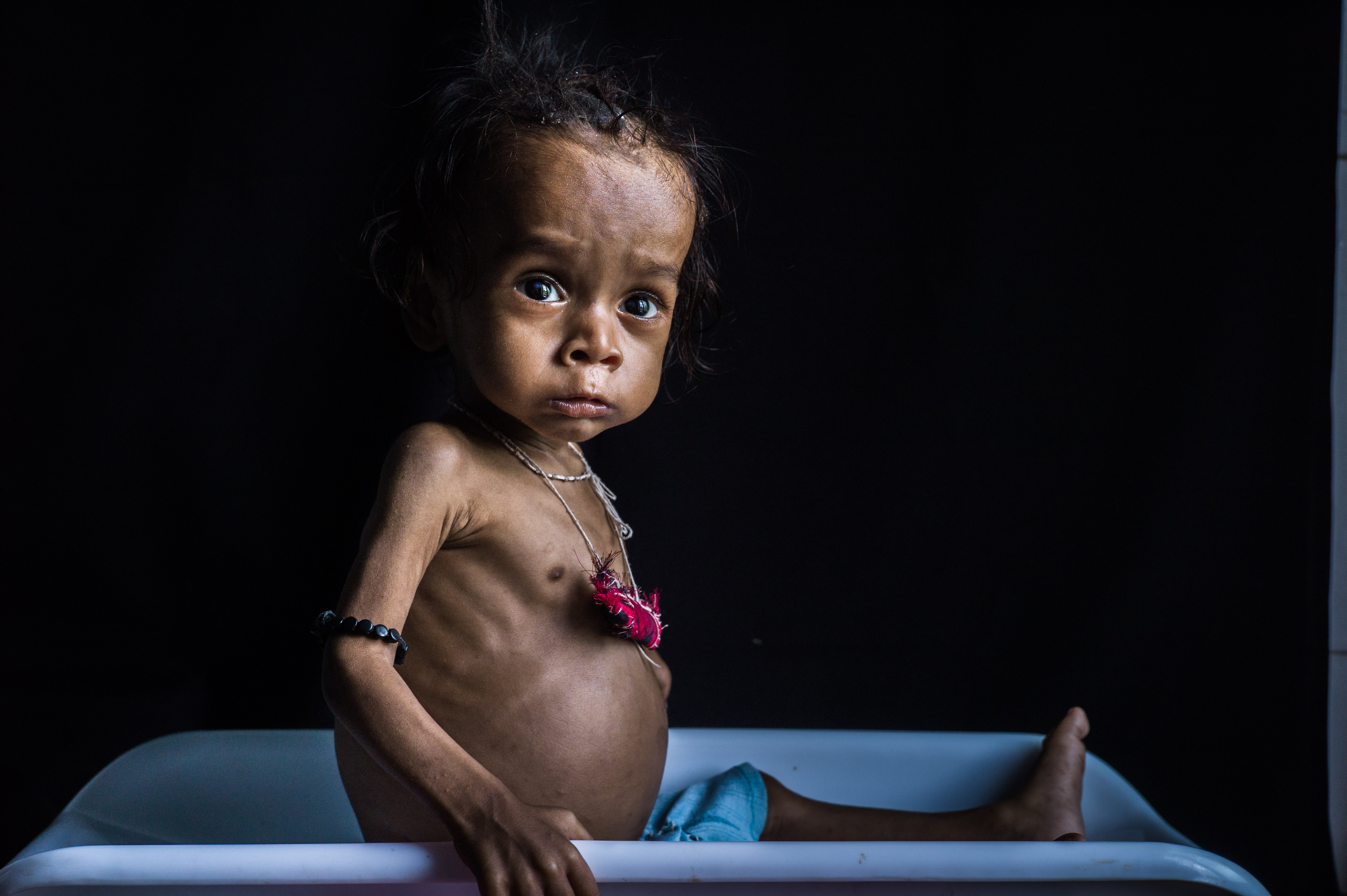 Lets Break the Chain of Hunger